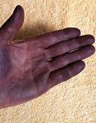 ���v���v